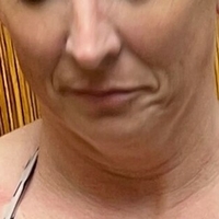 Beautifulpbrbabe Meztelen