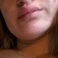 meribabe Meztelen