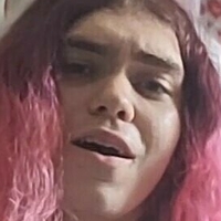 roseyccomplexion Meztelen