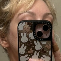 starrydears Meztelen