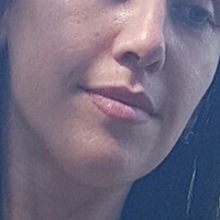 Wirtoly Meztelen